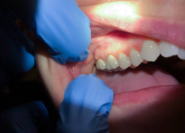 Best Broken Tooth Emergency  in Barclay, NJ