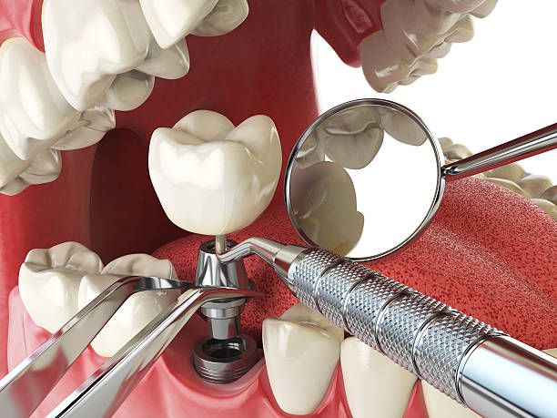 Best Urgent Tooth Repair  in Barclay, NJ